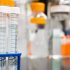 To Do OR Not To Do: Are Screening Tests Required Post-50?