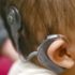 Cochlear Implant Program in Rural India