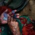 COVID-19 Pandemic Pushed Over Half a Billion People into Poverty: WHO