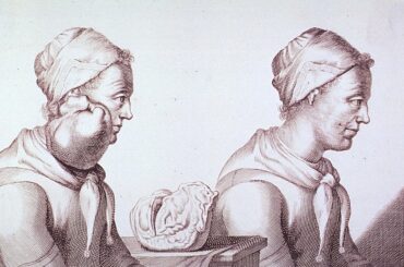 A Brief History of Cancer
