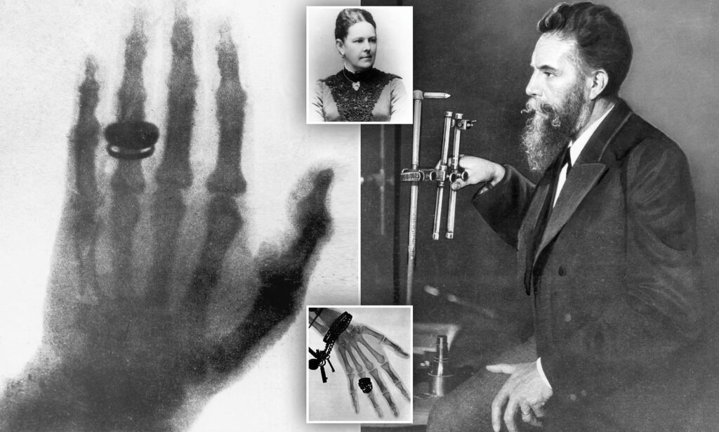 Roentgen's first human X-ray of his wife's hand in 1895 | Courtesy: Daily Mail