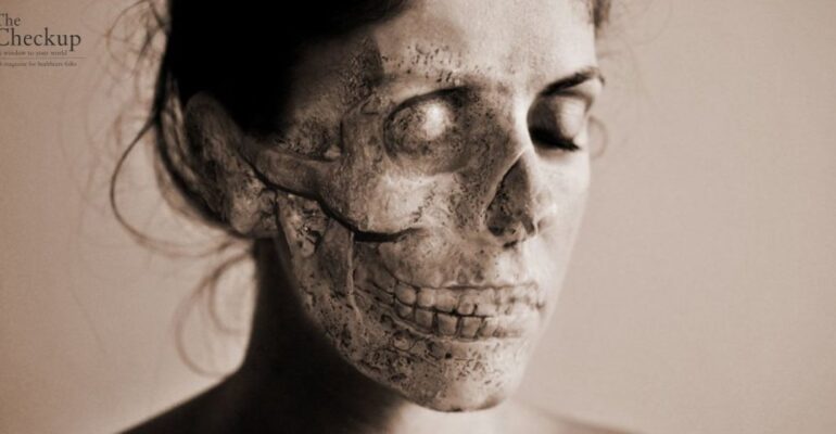 Walking Corpse Syndrome
