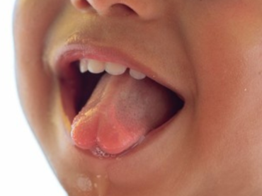 Spit it out