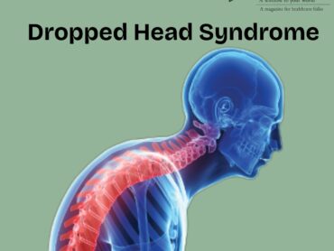 Dropped Head Syndrome